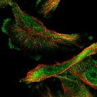 Immunofluorescent staining of human cell line U-251 MG shows localization to nucleoplasm & plasma membrane.