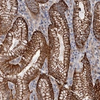 Anti-C12orf76 Antibody