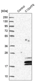 Western blot analysis in control (vector only transfected HEK293T lysate) and C12orf76 over-expression lysate (Co-expressed with a C-terminal myc-DDK tag (~3.1 kDa) in mammalian HEK293T cells, LY404032).