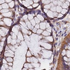 Immunohistochemical staining of human colon using Anti-DCTN2 antibody HPA039715.