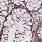 Immunohistochemical staining of human colon using Anti-DCTN2 antibody HPA039715.