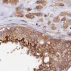 Immunohistochemical staining of human testis using Anti-DCTN2 antibody HPA039715.