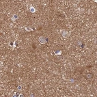 Immunohistochemical staining of human cerebral cortex using Anti-DCTN2 antibody HPA039715.