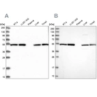 Western blot analysis using Anti-DCTN2 antibody HPA039715 (A) shows similar pattern to independent antibody HPA040040 (B).