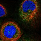 Immunofluorescent staining of human cell line A-431 shows localization to cytosol & centrosome.