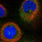 Immunofluorescent staining of human cell line A-431 shows localization to cytosol & centrosome.