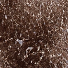 Anti-AMDHD1 Antibody