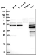 Western blot analysis in human cell line RT-4, human cell line U-251 MG, human plasma and human liver tissue.