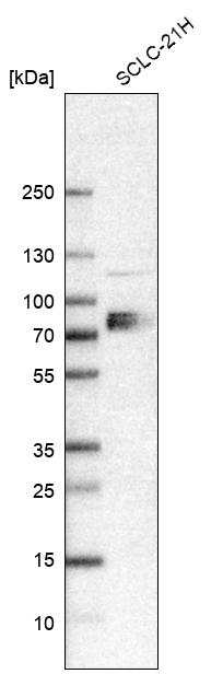 Anti-SLC7A1 Antibody