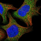 Immunofluorescent staining of human cell line U-2 OS shows localization to cytosol.