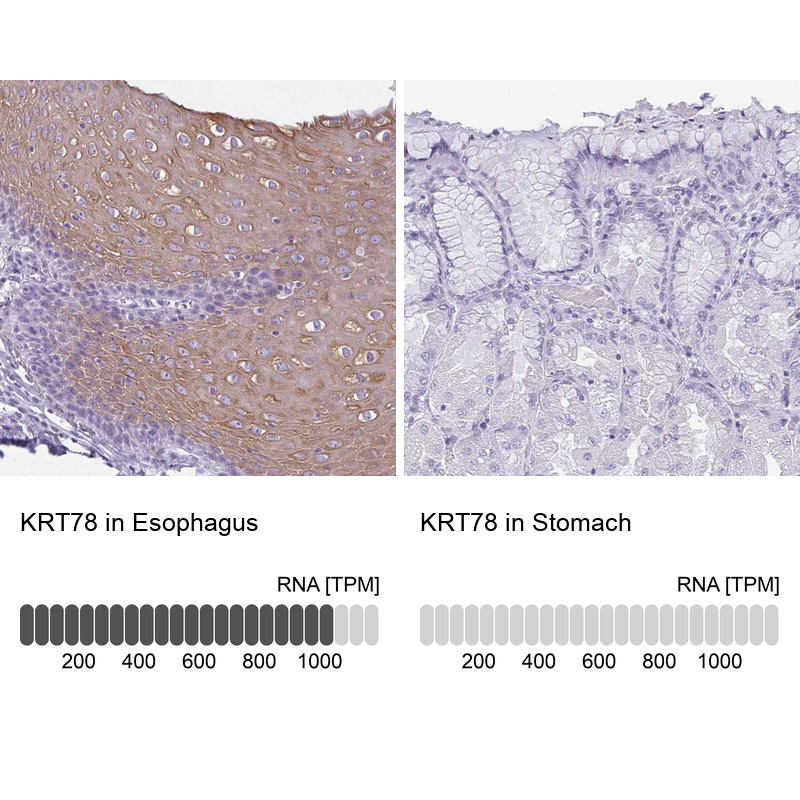 Anti-KRT78 Antibody