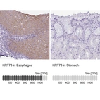 Anti-KRT78 Antibody