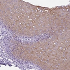 Immunohistochemical staining of human esophagus shows moderate cytoplasmic positivity in squamous epithelial cells.
