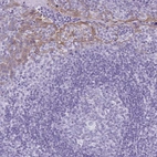 Immunohistochemical staining of human tonsil shows weak to moderate cytoplasmic positivity in squamous epithelial cells.