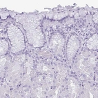 Immunohistochemical staining of human stomach shows no positivity in glandular cells as expected.