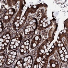 Anti-SDHAF2 Antibody