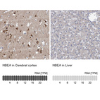 Anti-NBEA Antibody