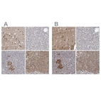 Immunohistochemical staining of human cerebral cortex, liver, pancreas and stomach using Anti-NBEA antibody HPA039730 (A) shows similar protein distribution across tissues to independent antibody HPA040385 (B).