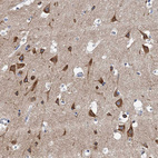 Immunohistochemical staining of human cerebral cortex shows strong cytoplasmic positivity in neurons.