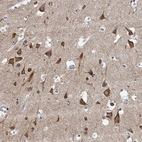 Immunohistochemical staining of human cerebral cortex shows strong cytoplasmic positivity in neurons.