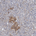 Immunohistochemical staining of human pancreas shows moderate cytoplasmic positivity in islets of Langerhans.