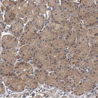 Immunohistochemical staining of human stomach shows moderate cytoplasmic positivity in glandular cells.