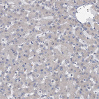 Immunohistochemical staining of human liver shows no positivity in hepatocytes as expected.