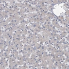 Immunohistochemical staining of human liver shows no positivity in hepatocytes as expected.
