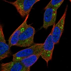 Immunofluorescent staining of human cell line SH-SY5Y shows localization to cytosol & the Golgi apparatus.