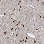 Immunohistochemical staining of human cerebral cortex using Anti-CSTF3 antibody HPA039743.