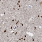 Immunohistochemical staining of human cerebral cortex using Anti-CSTF3 antibody HPA039743.
