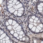 Immunohistochemical staining of human colon using Anti-CSTF3 antibody HPA039743.