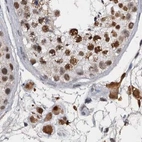 Immunohistochemical staining of human testis using Anti-CSTF3 antibody HPA039743.