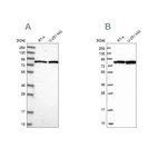 Western blot analysis using Anti-CSTF3 antibody HPA039743 (A) shows similar pattern to independent antibody HPA040168 (B).