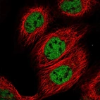 Immunofluorescent staining of human cell line A-431 shows localization to nucleoplasm.