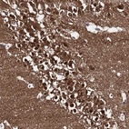 Anti-CAPRIN2 Antibody