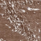 Anti-CAPRIN2 Antibody