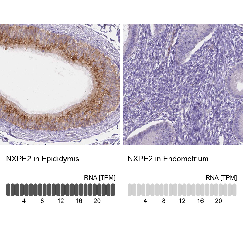 Anti-NXPE2 Antibody