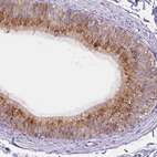 Immunohistochemical staining of human epididymis shows high expression.