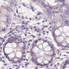 Immunohistochemical staining of human colon using Anti-NXPE2 antibody HPA039744.