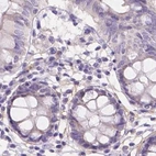 Immunohistochemical staining of human colon using Anti-NXPE2 antibody HPA039744.