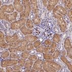 Anti-OSGEP Antibody