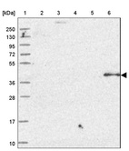 Lane 1: Marker [kDa] 250, 130, 95, 72, 55, 36, 28, 17, 10_br/_Lane 2: Human cell line RT-4_br/_Lane 3: Human cell line U-251MG sp_br/_Lane 4: Human plasma (IgG/HSA depleted)_br/_Lane 5: Human liver tissue_br/_Lane 6: Human tonsil tissue
