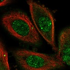 Immunofluorescent staining of human cell line PC-3 shows localization to nucleoplasm, nuclear speckles & plasma membrane.