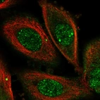 Immunofluorescent staining of human cell line PC-3 shows localization to nucleoplasm, nuclear speckles & plasma membrane.