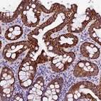 Anti-NAA16 Antibody