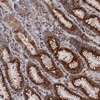 Anti-LRRC63 Antibody