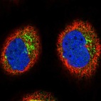 Immunofluorescent staining of human cell line A-431 shows localization to the Golgi apparatus.