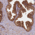 Immunohistochemical staining of human prostate shows strong cytoplasmic positivity in glandular cells.