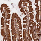 Immunohistochemical staining of human small intestine shows strong cytoplasmic positivity in glandular cells.